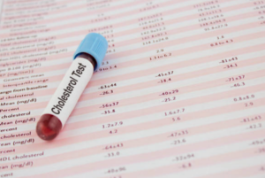 A blood test is sitting on top of a sheet of paper.