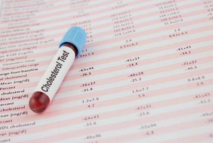 A blood test is sitting on top of a sheet of paper.